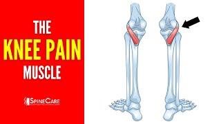 The Knee Pain Muscle (How to Release It for INSTANT RELIEF)